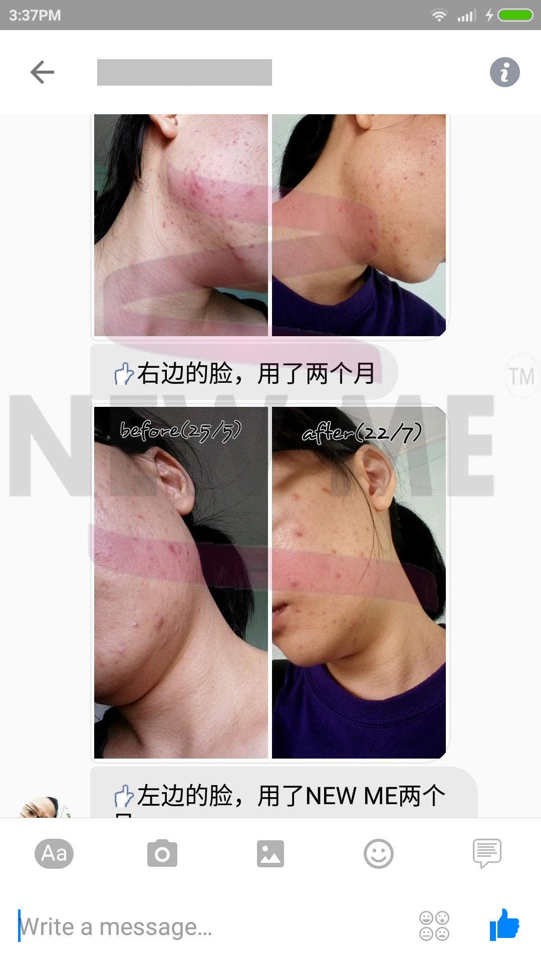 testima17aug